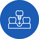 dental-implant